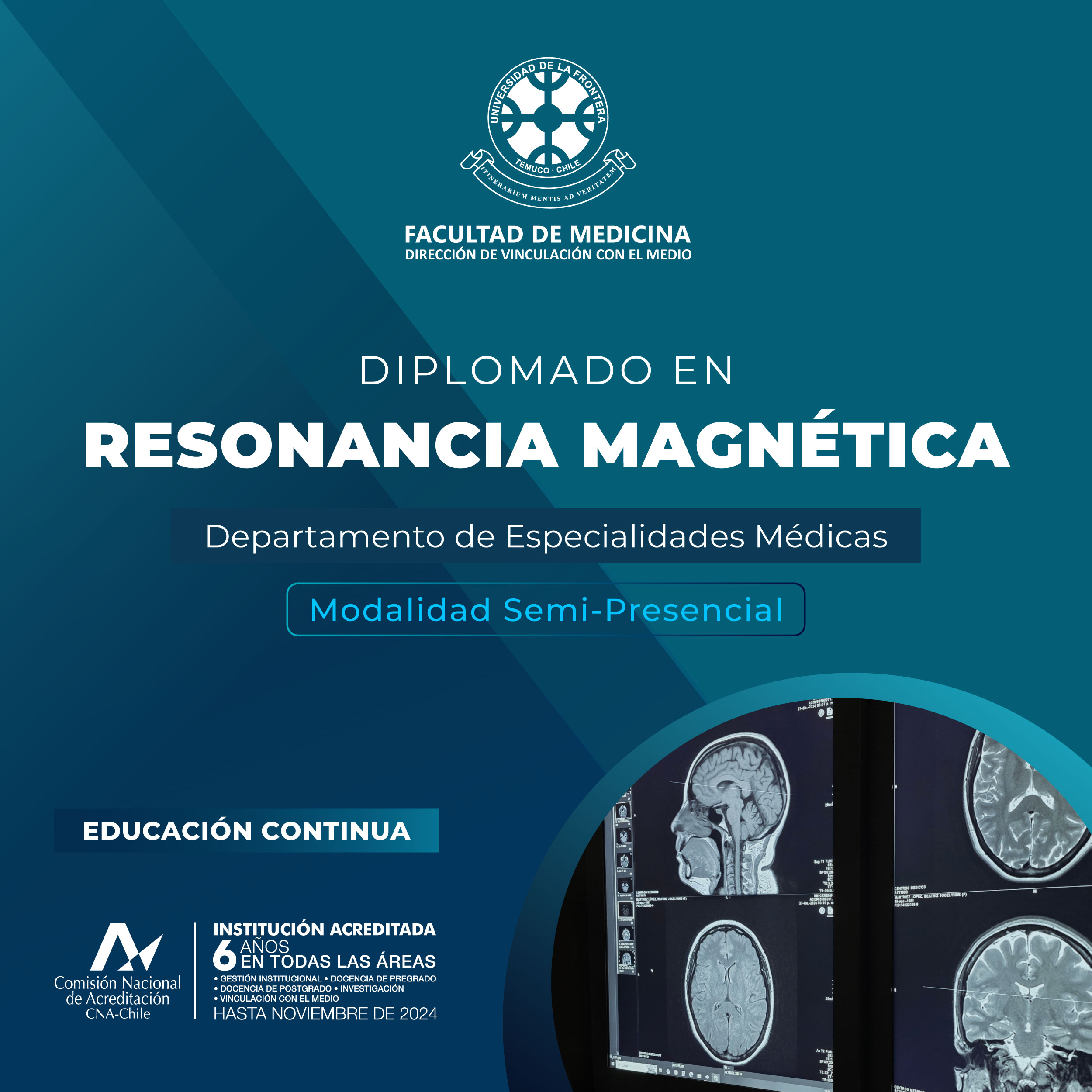 Diplomado_ResonanciaMagnetica_01